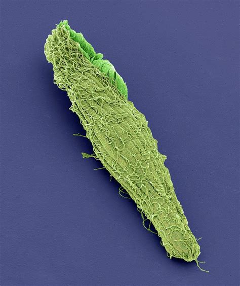  Blepharisma! A Ciliate That Challenges Expectations With Its Predatory Prowess