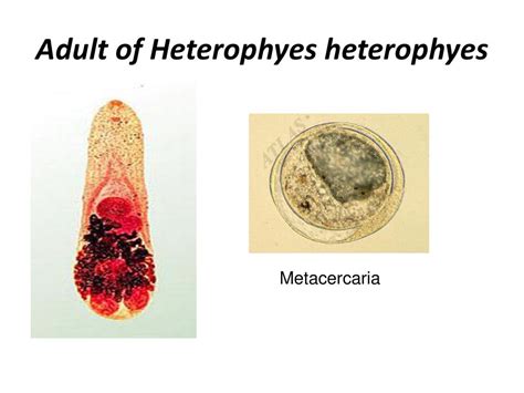  Heterophyes Heterophyes:  Unearthing the Mysteries Behind This Tiny Intestinal Dweller!